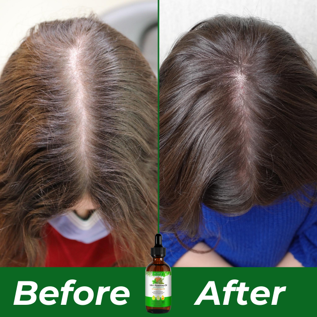 F51 Follicle Boost Kit