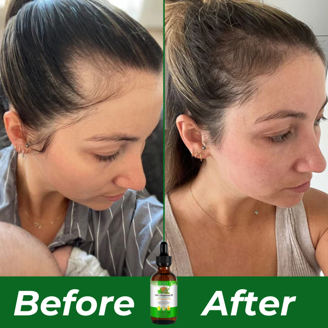 F51 Follicle Boost Kit